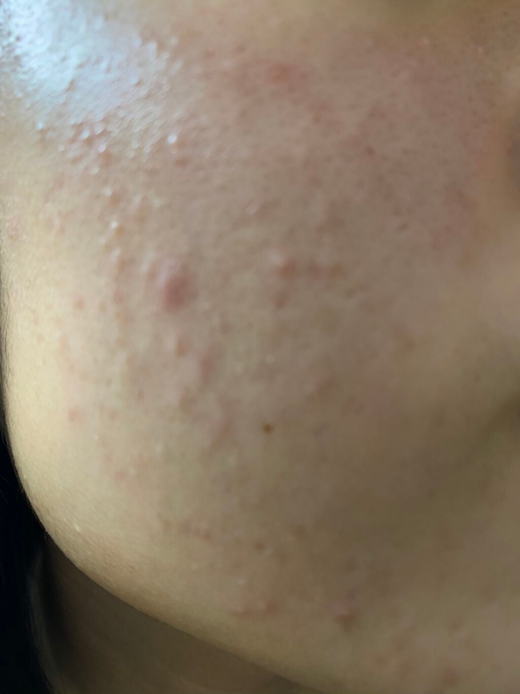 ハトムギ保湿ジェル(ナチュリエ スキンコンディショニングジェル)/ナチュリエ/美容液を使ったクチコミ(4枚目)