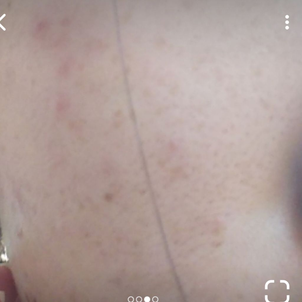 DHC ビタミンCハードカプセル/DHC/美容サプリメントを使ったクチコミ(2枚目)