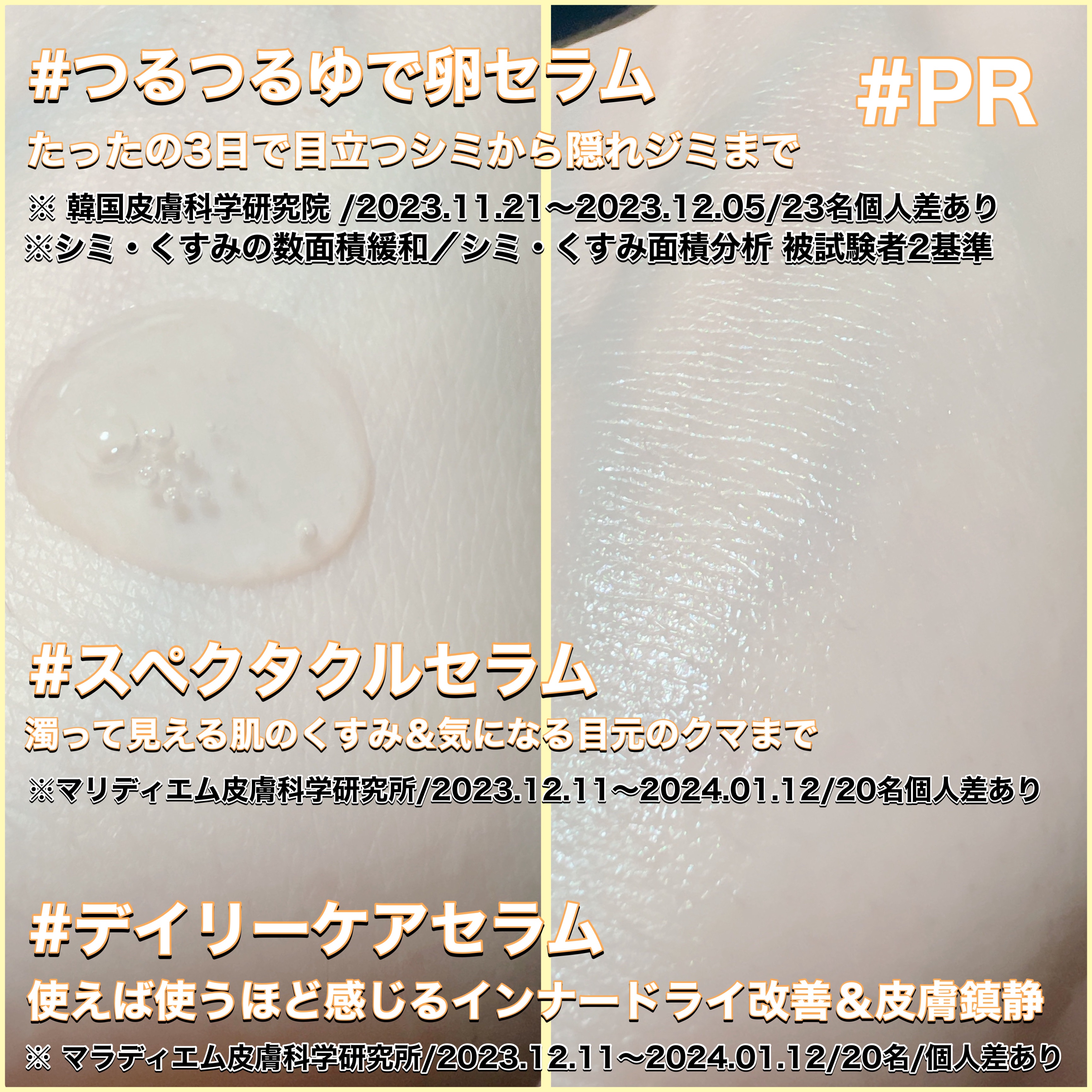 バイオームビタCダークスポットセラム/UIQ/美容液を使ったクチコミ（3枚目）