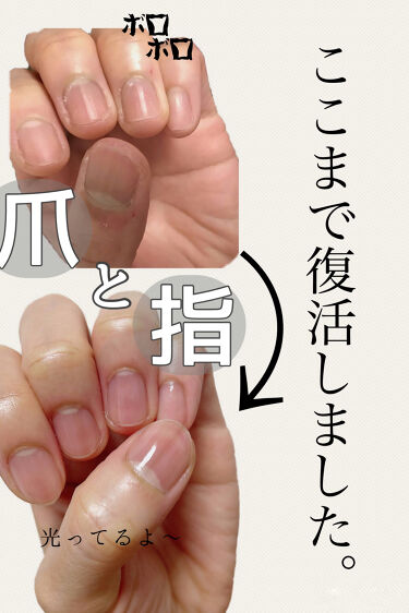 試してみた ベルベットスムーズ 電動ネイルケアキット ドクター ショール Lips