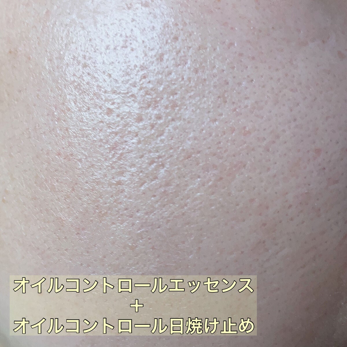 オイルコントロールカプセルエッセンス/celimax/美容液を使ったクチコミ(4枚目)