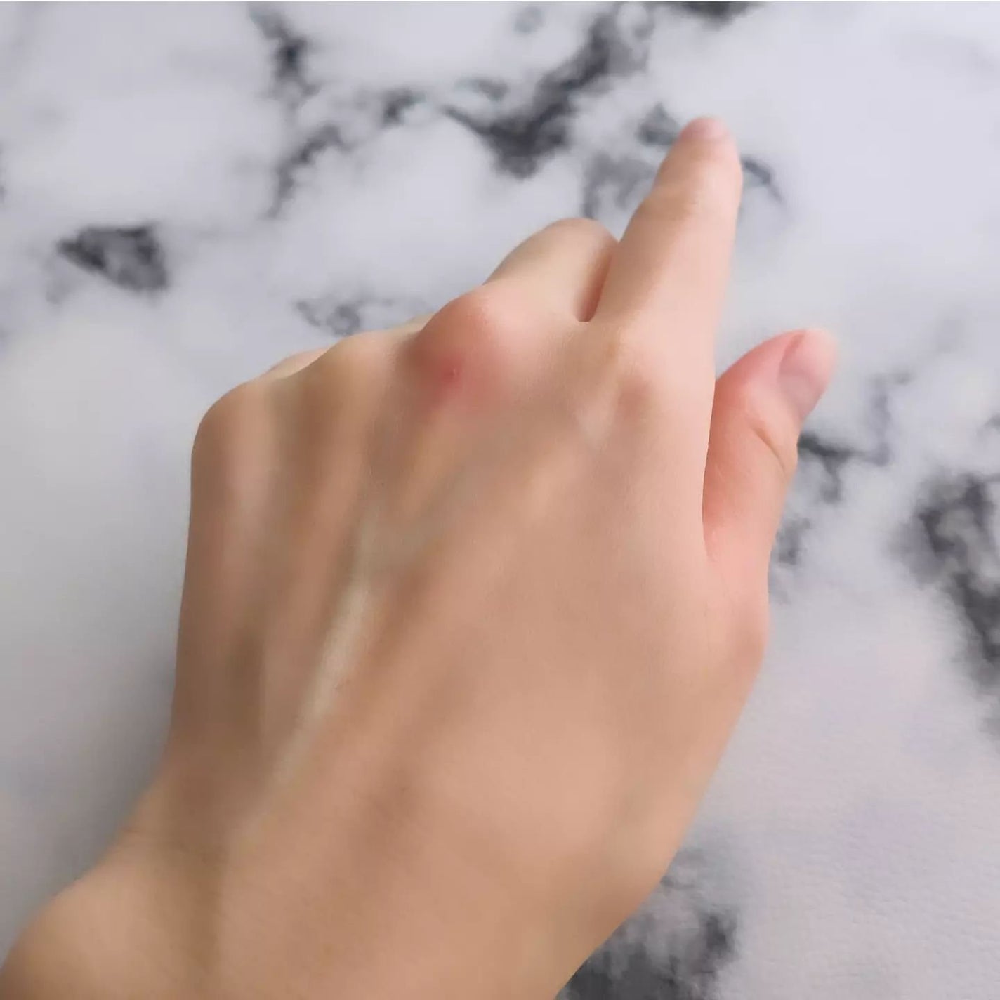 ナチュラルビオバランシングローション/LIALUSTER/化粧水を使ったクチコミ(6枚目)