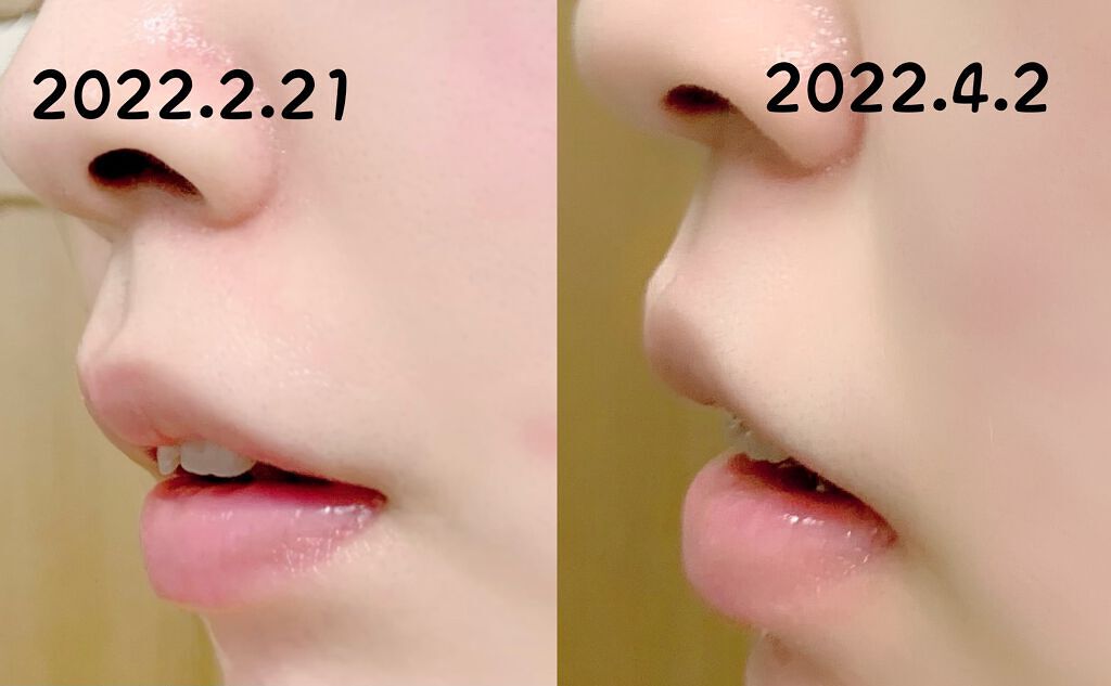 コンクールF/ウエルテック/マウスウォッシュ・スプレーを使ったクチコミ(8枚目)