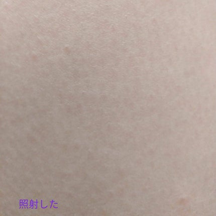 光脱毛器 VIO/Sarlisi/家庭用脱毛器を使ったクチコミ(5枚目)