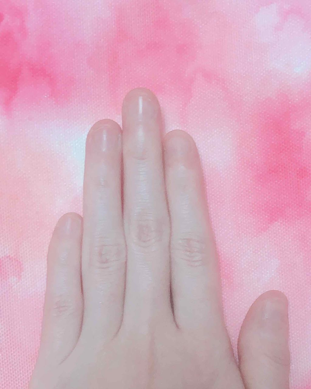 じゃがじゃが on LIPS 「2枚目爪の写真あり⚠️私爪を触ったりめくる癖が昔から抜けなくて..」(2枚目)