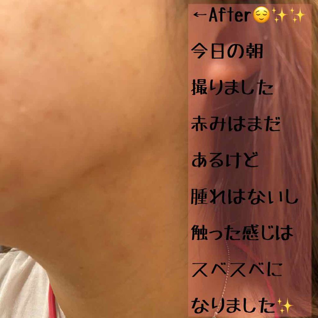 MAAs リペアエッセンス/Dr. Choi's Solution/美容液を使ったクチコミ（3枚目）