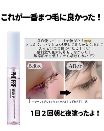 ðºð¬ðµðšðçŸå®¹ã¡ãã£ã¢ on LIPS ãã»ã(@sena_skincare.girl)ä»ã®æçš¿ã¯ãã¡ã..ãïŒ6æç®ïŒ