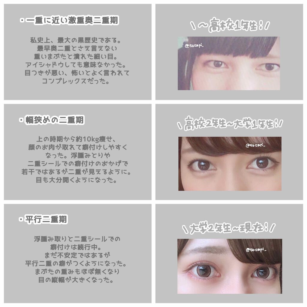 二重になる方法 二重まぶた用シール Daisoの使い方や二重メイク 二重について By 仮姫 代前半 Lips