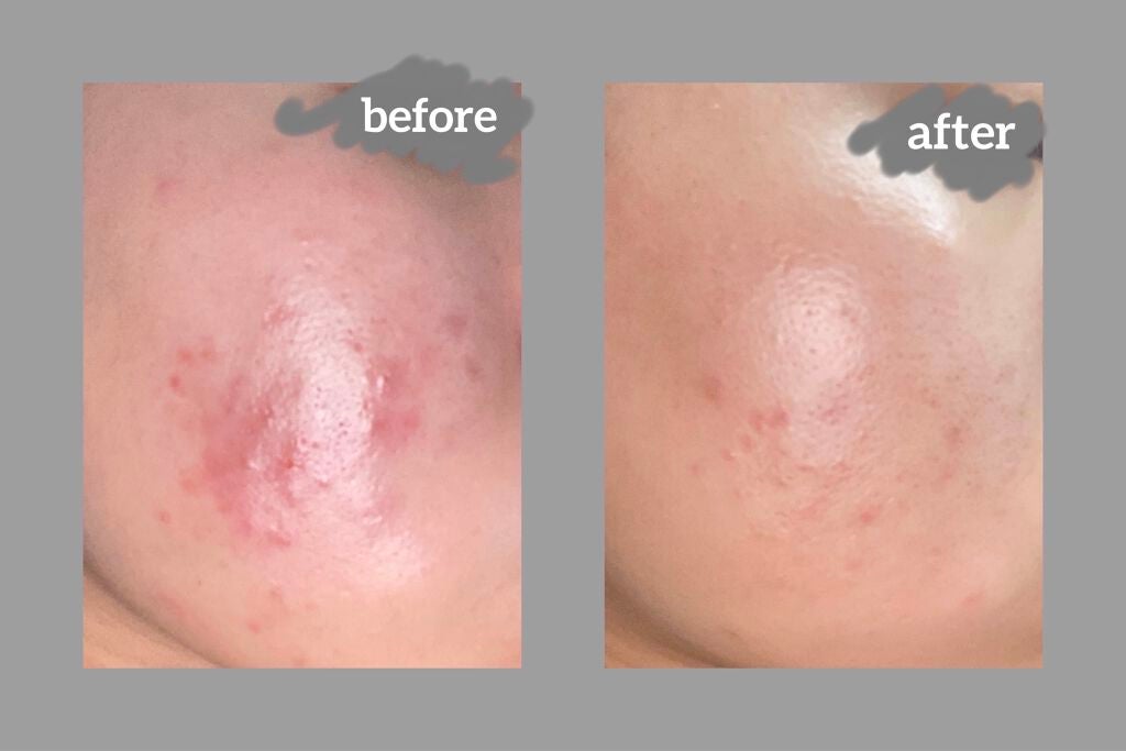 DHC ビタミンBミックス/DHC/美容サプリメントを使ったクチコミ(2枚目)