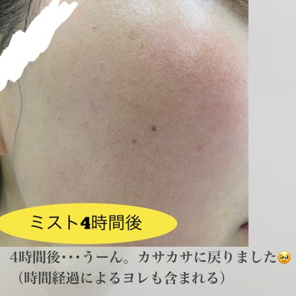 エリクシール シュペリエル つや玉ミスト/エリクシール/ミスト状化粧水を使ったクチコミ(5枚目)