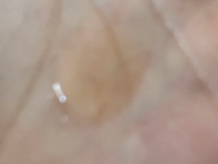 ドクダミ 77 スージングトナー/Anua/化粧水を使ったクチコミ(6枚目)