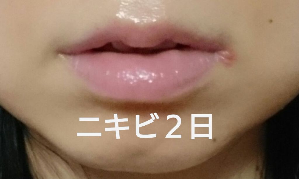 V コントア セラム/CLARINS/美容液を使ったクチコミ（1枚目）