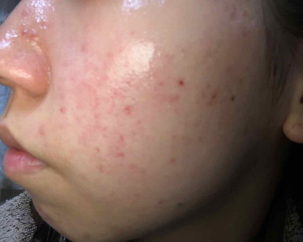 ウォッシャブル コールド クリーム/ちふれ/クレンジングクリームを使ったクチコミ（3枚目）