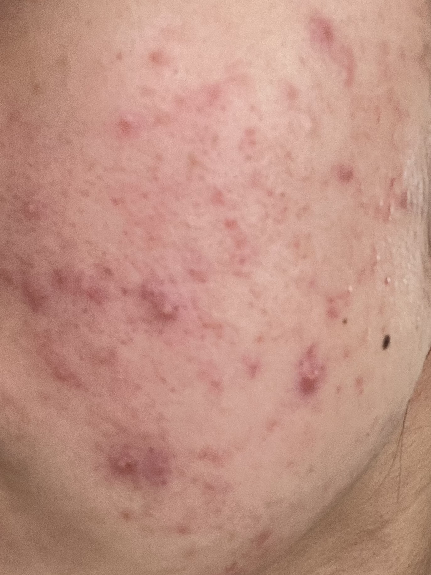 皮脂トラブルケア 化粧水/キュレル/化粧水を使ったクチコミ（2枚目）