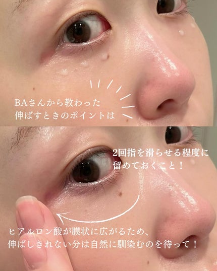 カプチュール トータル ヒアルショット/Dior/美容液を使ったクチコミ(3枚目)