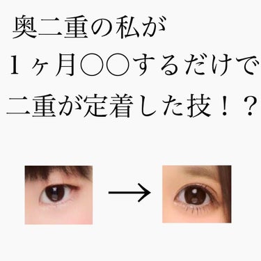 ダイソーアイテープ😘

私は片目二重片目奥二重という目の大きさが違って見えるという最悪の目でした。。😢

私は今まで色々試しました。アイプチ、メザイクなど。

でもアイプチは変な目になるし、メザイクは取