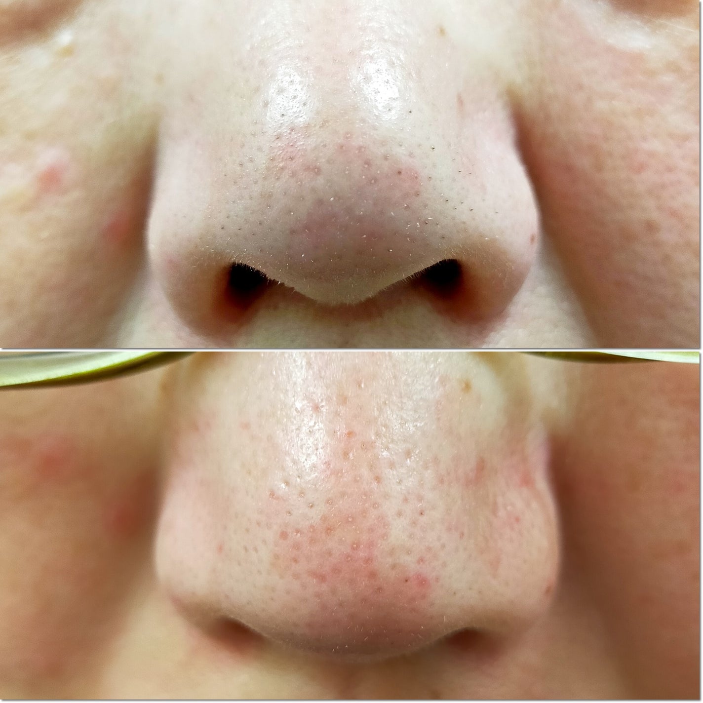 ゼロ毛穴クレイパック/MEDICUBE/洗い流すパック・マスクを使ったクチコミ(4枚目)