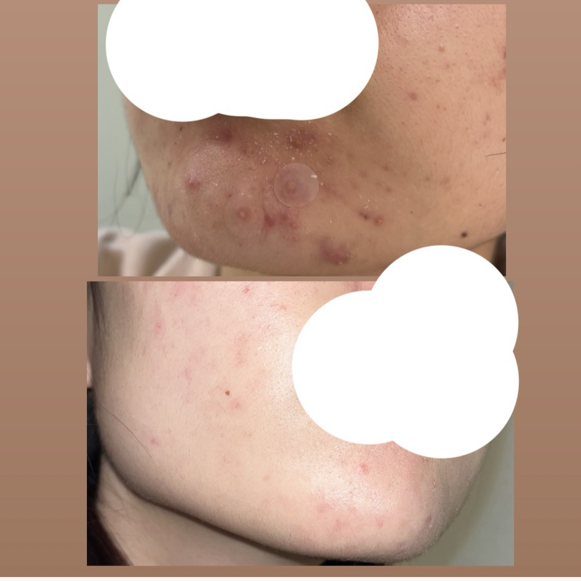 THE N.M.F アクア トナー/MEDIHEAL/化粧水を使ったクチコミ（2枚目）