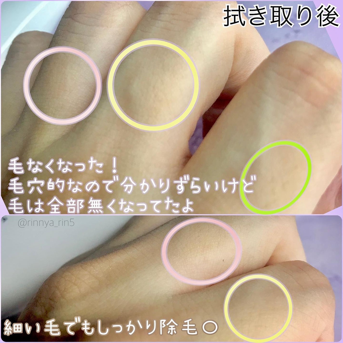 リムーバークリームHIG/Loro Schon/除毛クリームを使ったクチコミ(6枚目)