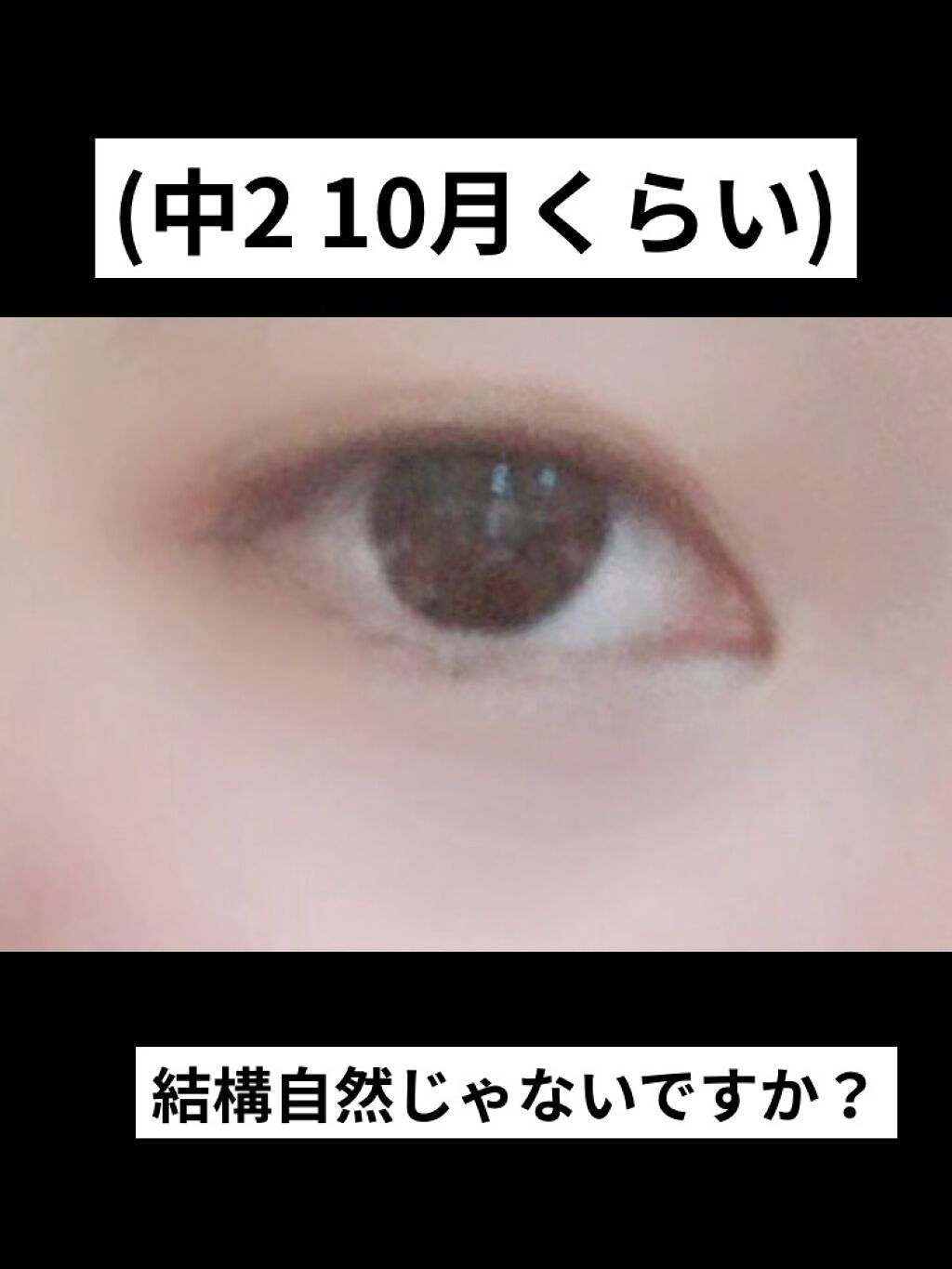 ダブルアイリキッド/Automatic Beauty/二重まぶた用アイテムを使ったクチコミ（3枚目）