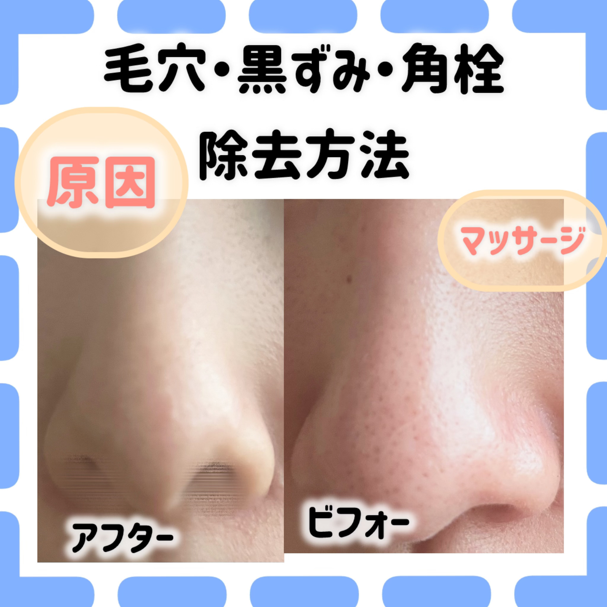 ベビーオイル/KUMANO COSMETICS/ボディオイルを使ったクチコミ（1枚目）