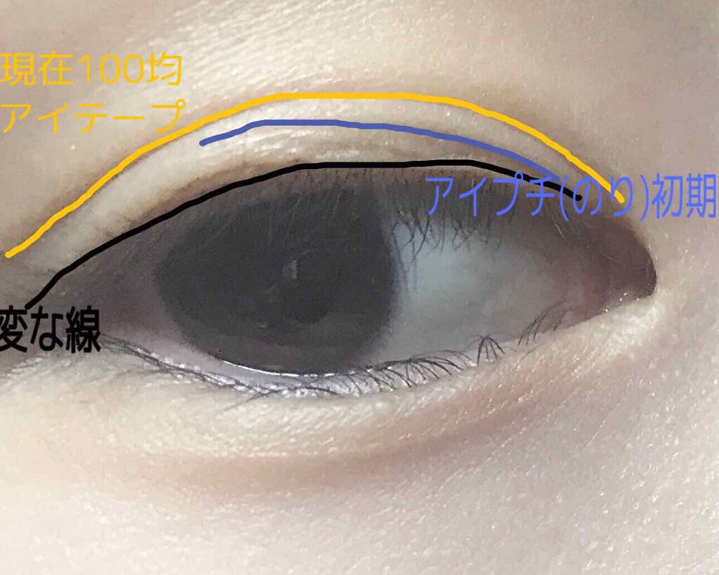 アイトーク/アイトーク/二重まぶた用アイテムを使ったクチコミ（2枚目）