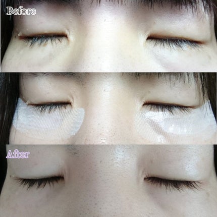 ナチュラベーレ THEマイクロニードル/ナチュラベーレ/シートマスク・パックを使ったクチコミ(7枚目)