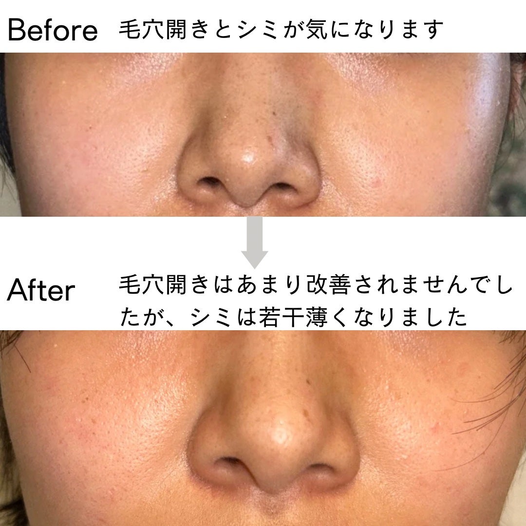 薬用 しみ 集中対策 美容液/メラノCC/美容液を使ったクチコミ(3枚目)