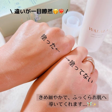 CBD モイストリペアローション/WALALA/化粧水を使ったクチコミ(5枚目)