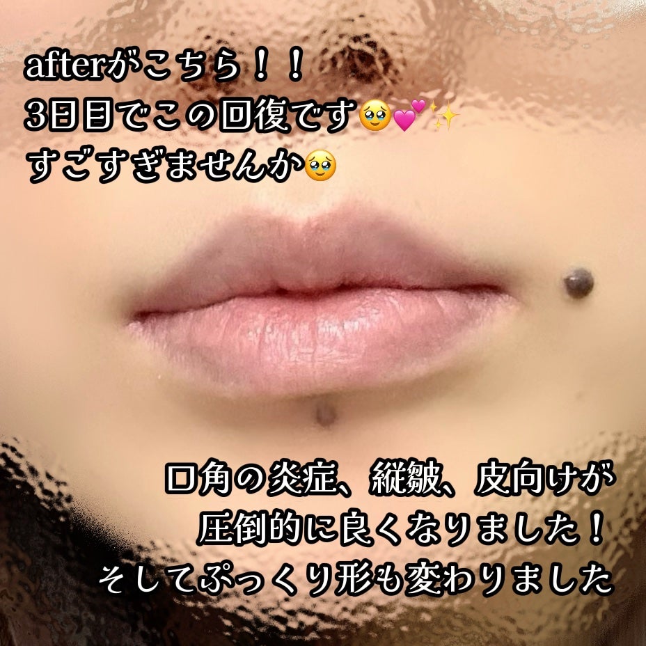 メンソレータム リペアワン ナイトケアリップ/メンソレータム/リップ美容液を使ったクチコミ(5枚目)