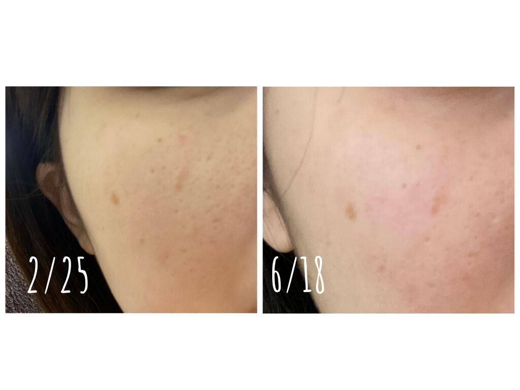 3番 すべすべキメケアセラム/numbuzin/美容液を使ったクチコミ(2枚目)