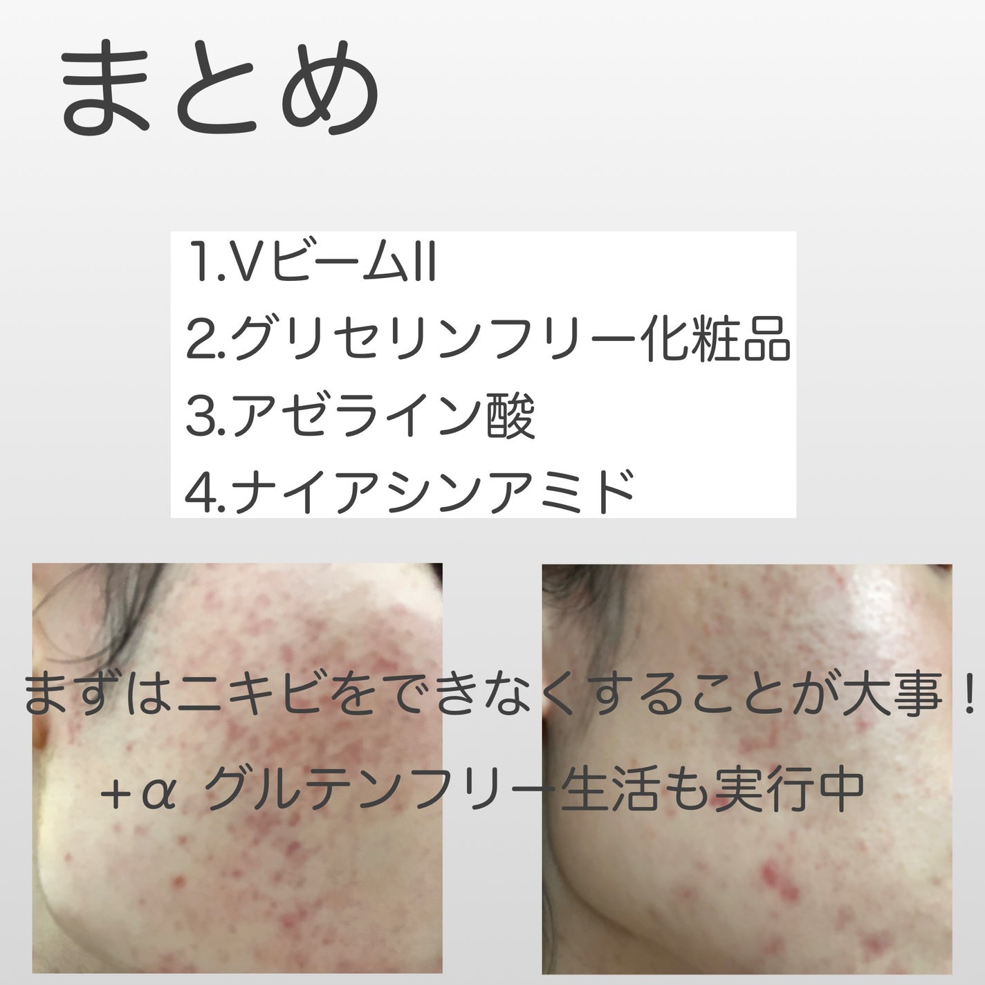 N10+Z1フェイスセラム /The Ordinary/美容液を使ったクチコミ(6枚目)