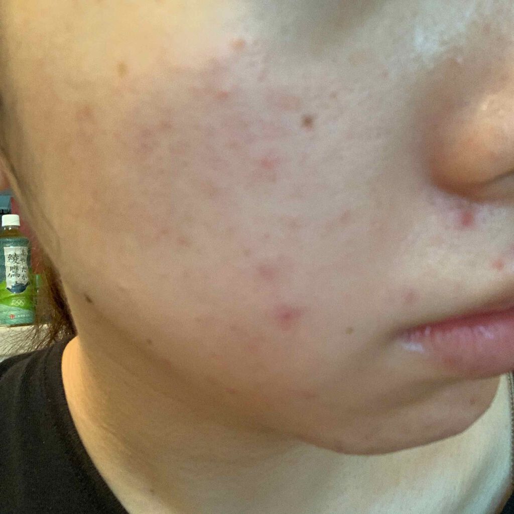 デュオ ザ クレンジングバーム/DUO/クレンジングバームを使ったクチコミ（3枚目）