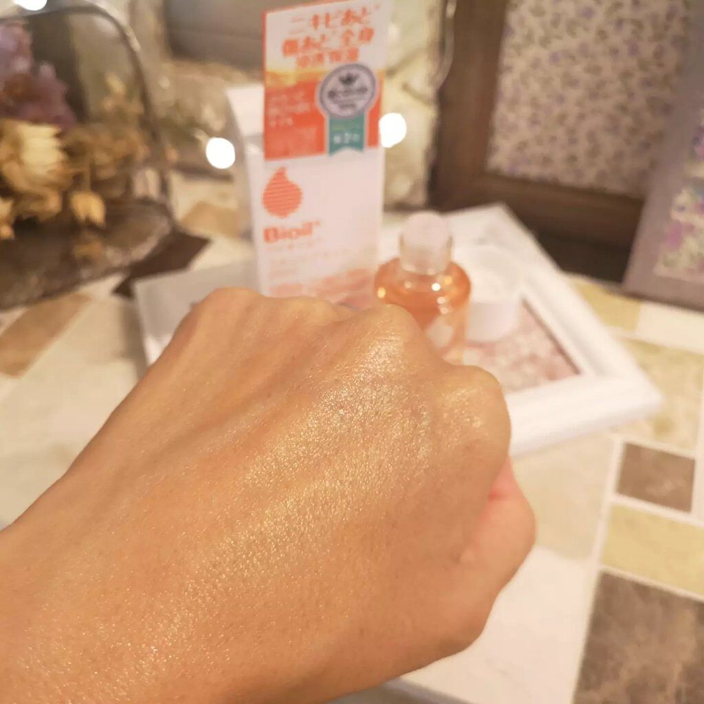 バイオイル/バイオイル/フェイスオイルを使ったクチコミ(3枚目)