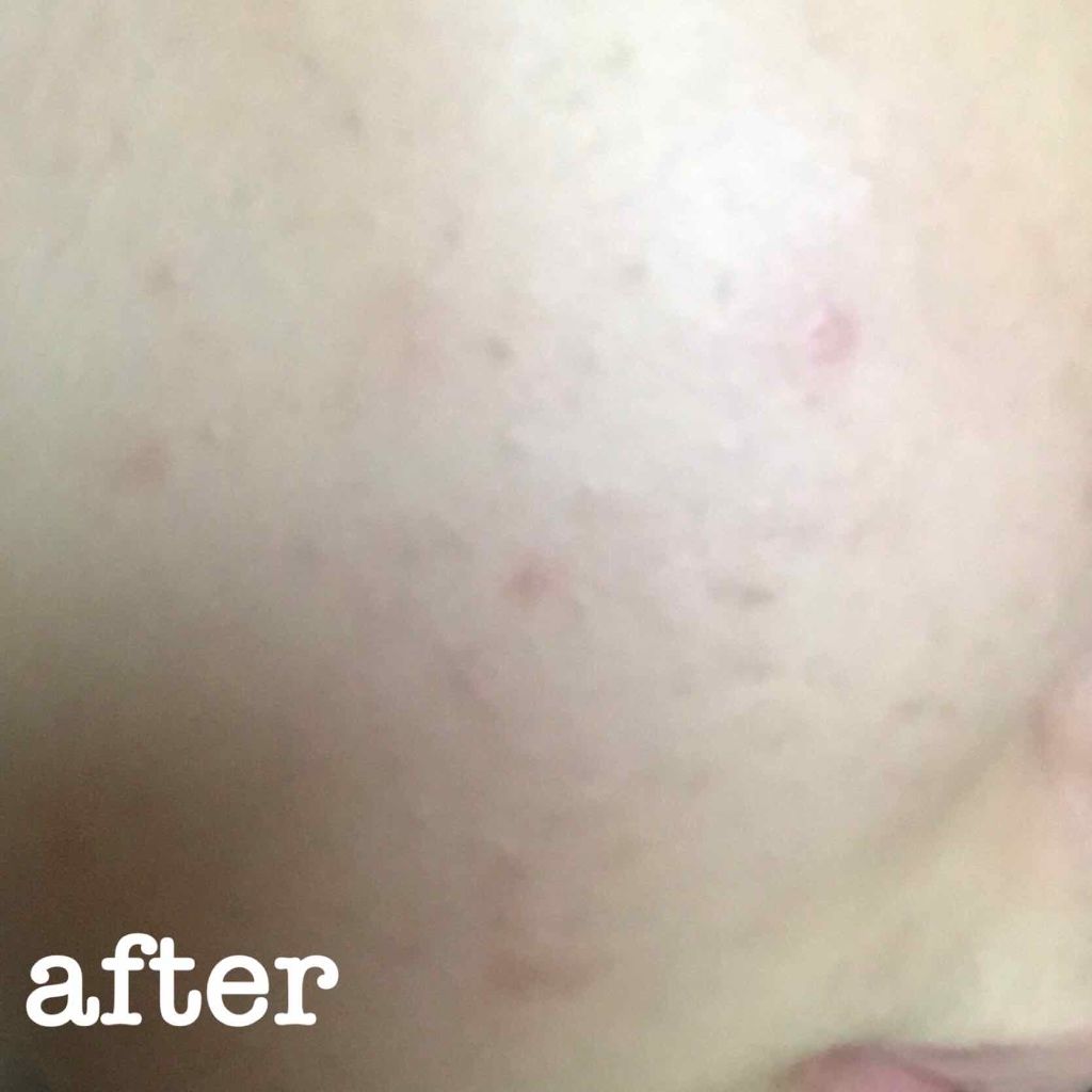 DHC ビタミンBミックス/DHC/美容サプリメントを使ったクチコミ(3枚目)