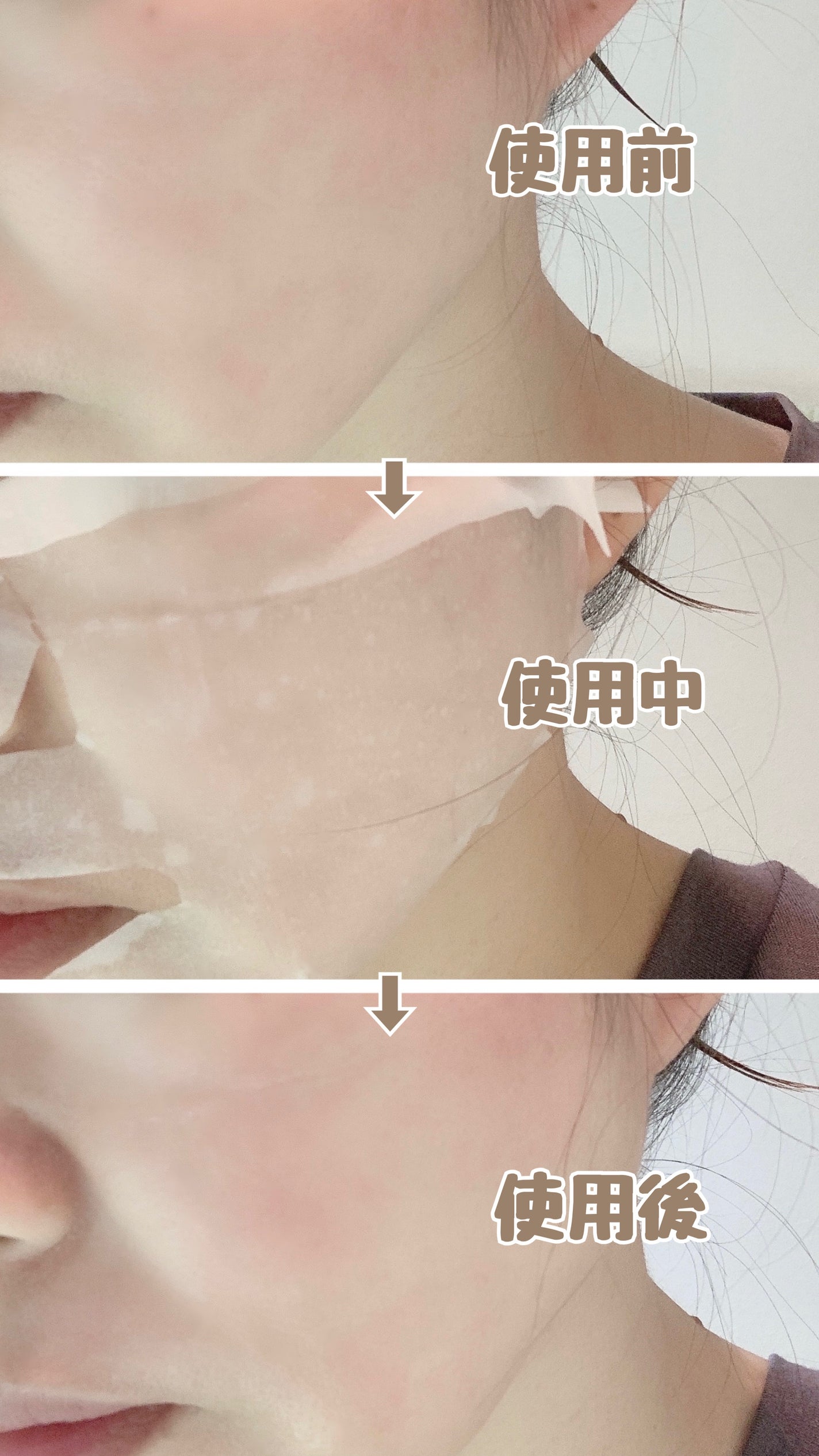 薬用リンクルフェイスマスク/akaran+/シートマスク・パックを使ったクチコミ(4枚目)