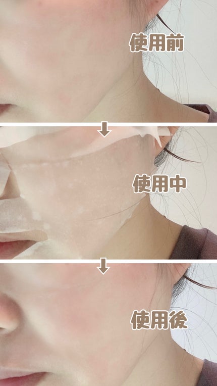 薬用リンクルフェイスマスク/akaran+/シートマスク・パックを使ったクチコミ(4枚目)