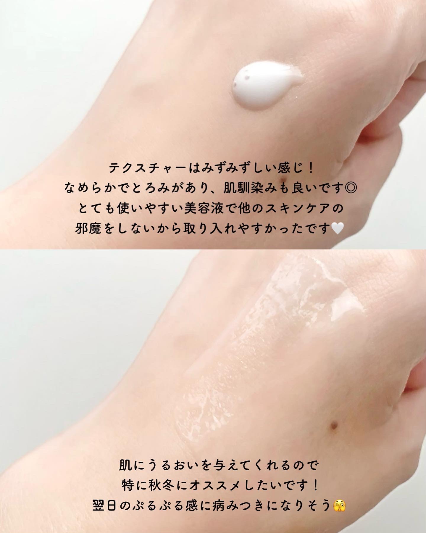 エージプロテオム/エステダム/美容液を使ったクチコミ（3枚目）