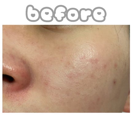 ミュゲナーアンプルマスク/CNP Laboratory/シートマスク・パックを使ったクチコミ(4枚目)