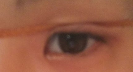 オロナインH軟膏 (医薬品)/オロナイン/その他を使ったクチコミ(2枚目)