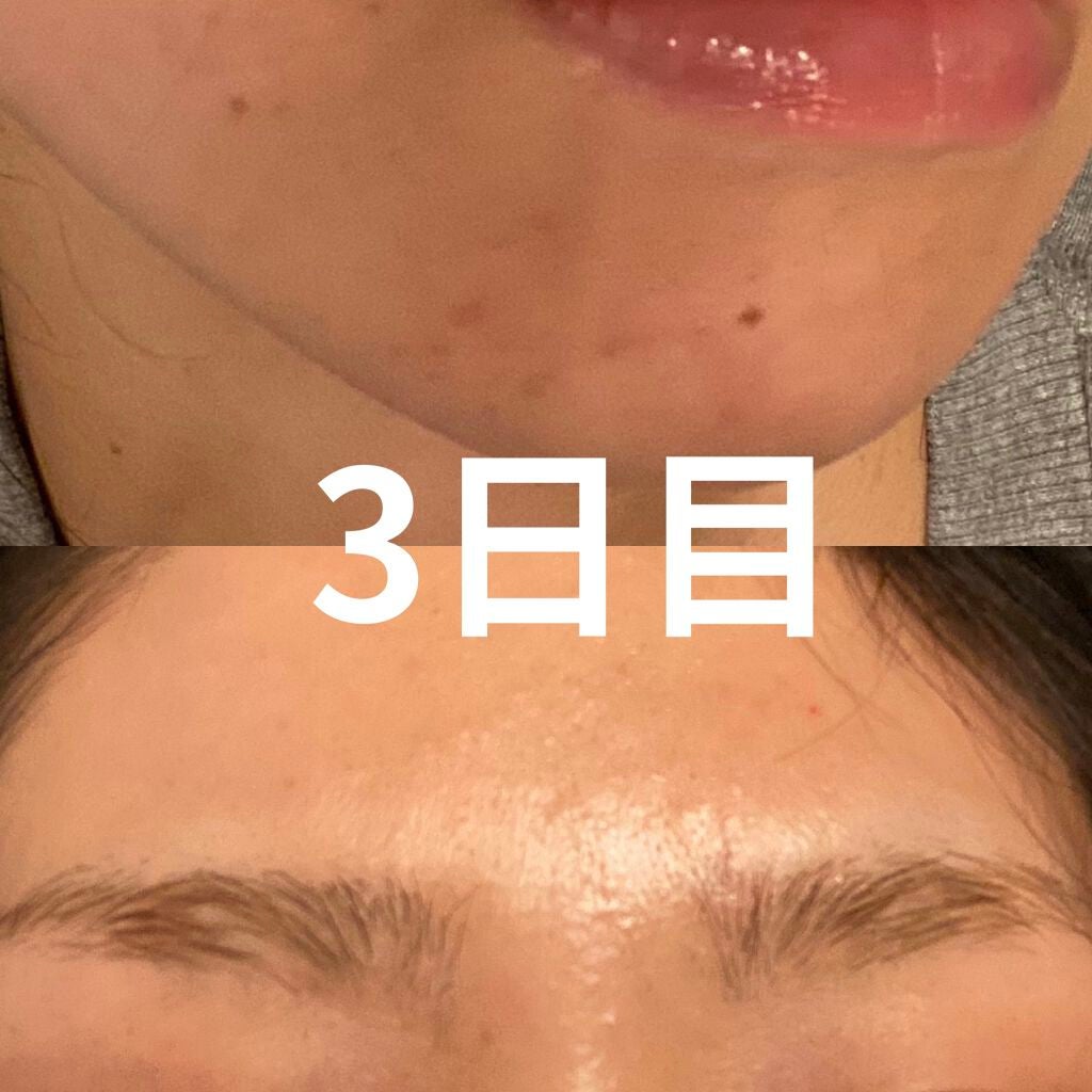 ティーツリーケアソリューション アンプルマスクJEX/MEDIHEAL/シートマスク・パックを使ったクチコミ(2枚目)