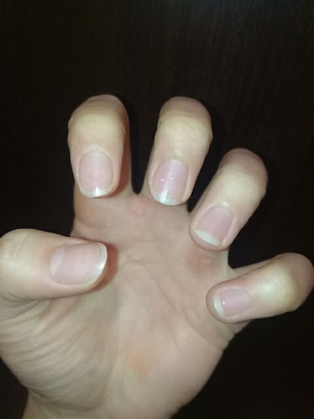 あ い う え お on LIPS 「わたしの爪ケアの方法を紹介します!!💅✨写真二枚目現在の手です..」(2枚目)