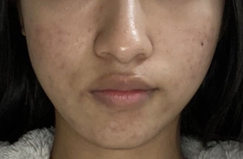 さけるチーズ/雪印メグミルク/食品を使ったクチコミ（3枚目）