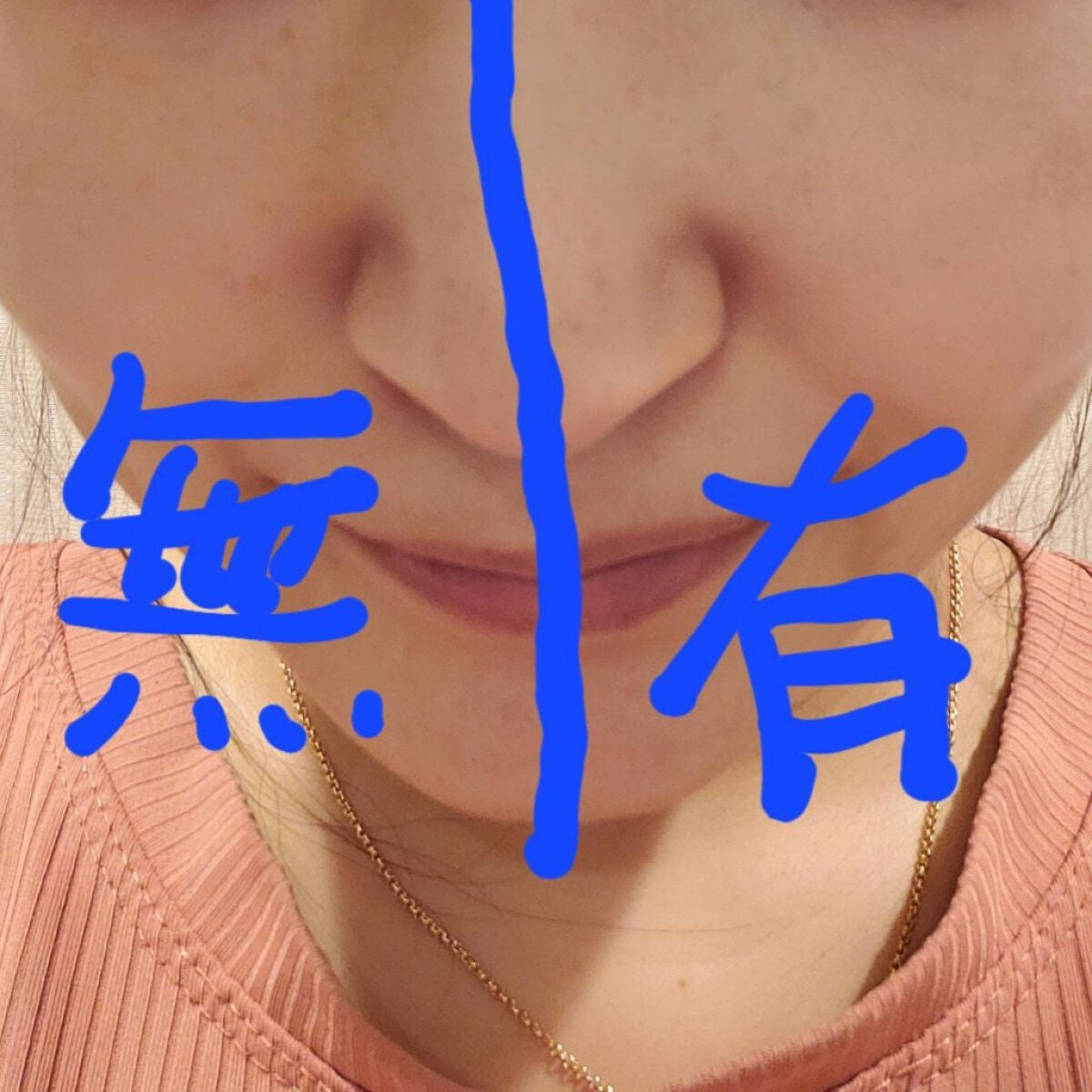 タトゥーウォータープルーフスカーコンシーラー/フォレンコス/リキッドコンシーラーを使ったクチコミ(3枚目)