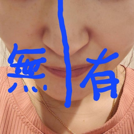 タトゥーウォータープルーフスカーコンシーラー/フォレンコス/リキッドコンシーラーを使ったクチコミ(3枚目)