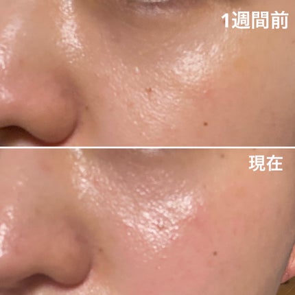 CICA デイリースージングマスク/VT/シートマスク・パックを使ったクチコミ(5枚目)