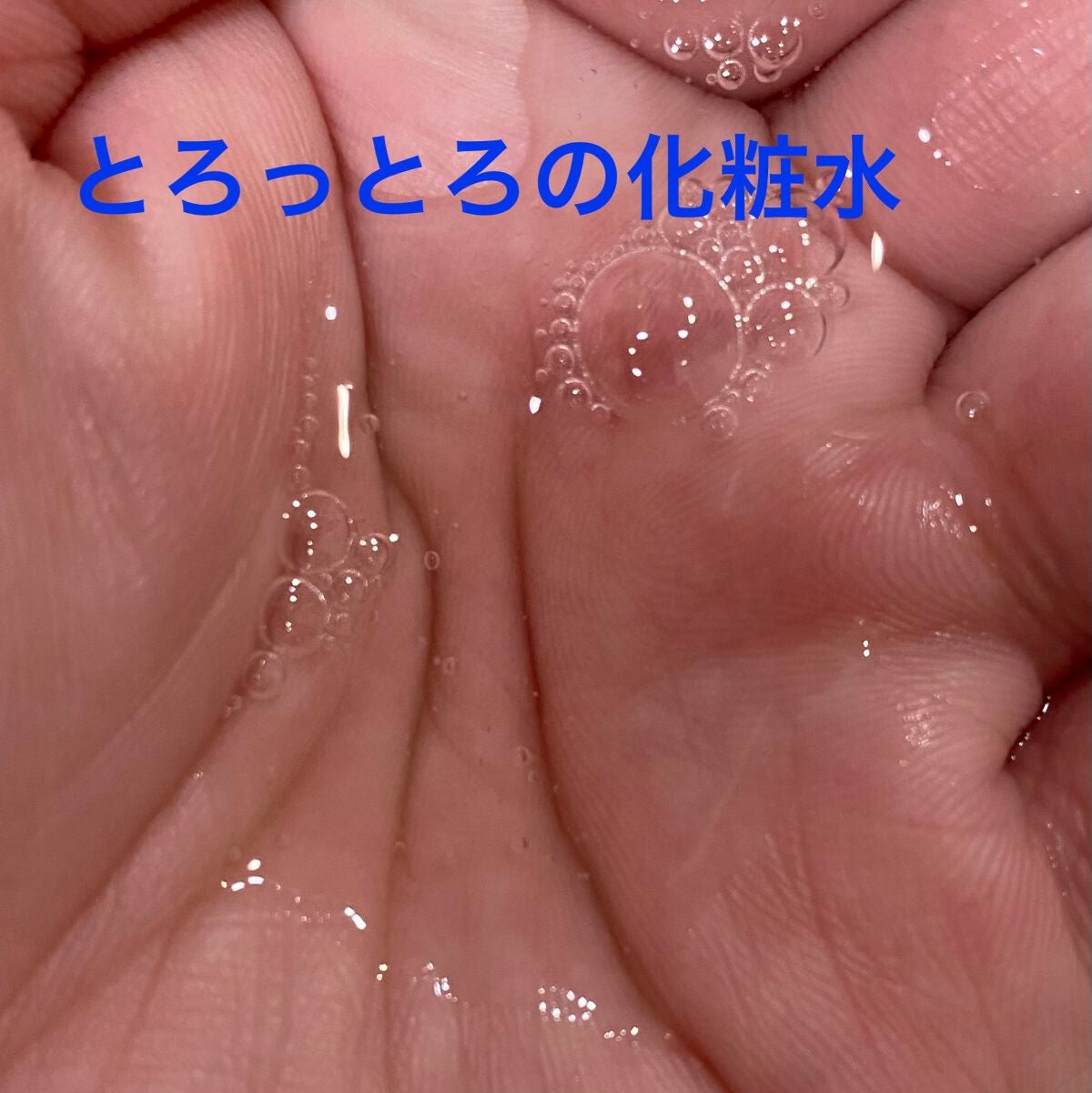 EPIS モイスチュアローション/EPIS/化粧水を使ったクチコミ(2枚目)