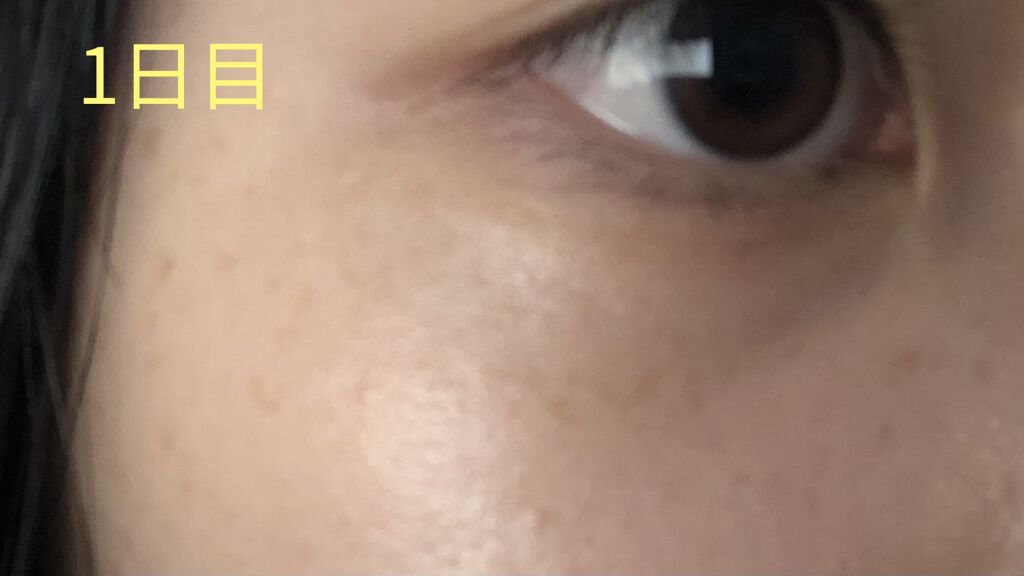 薬用 しみ 集中対策 美容液/メラノCC/美容液を使ったクチコミ（2枚目）