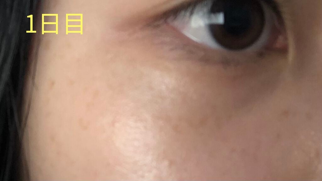 薬用 しみ 集中対策 美容液/メラノCC/美容液を使ったクチコミ(2枚目)