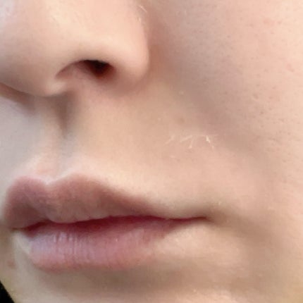 ダークスポットセラム/Anua/美容液を使ったクチコミ(2枚目)